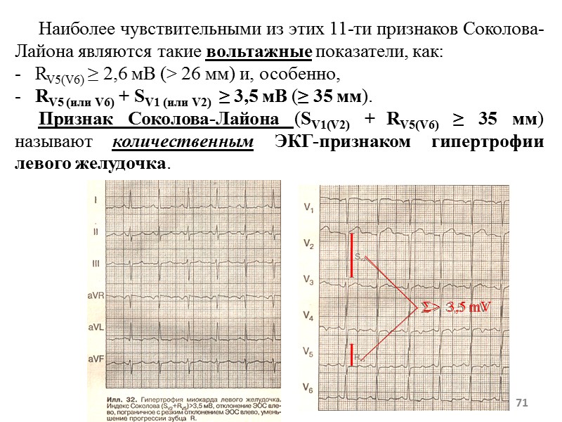 71 Наиболее чувствительными из этих 11-ти признаков Соколова-Лайона являются 71 Наиболее чувствительными из этих 11-ти признаков Соколова-Лайона являются